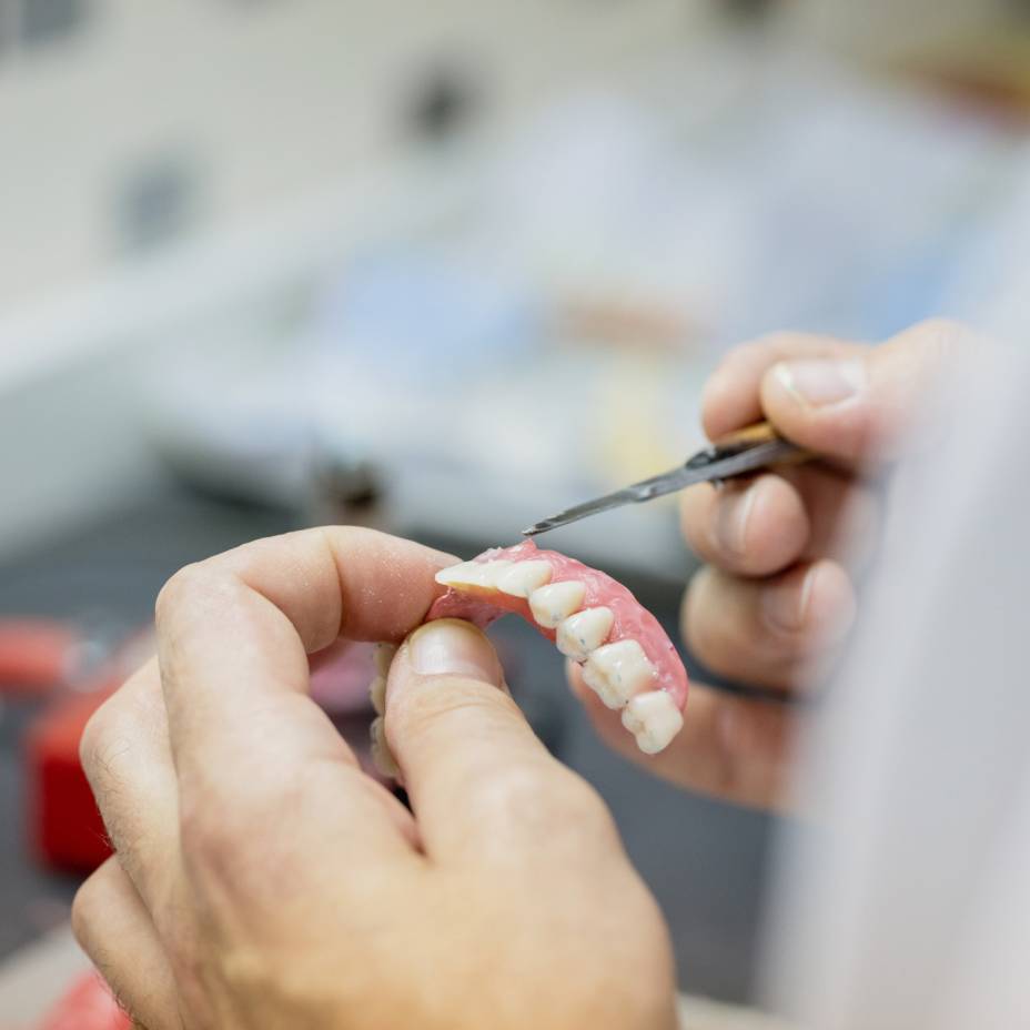 Zahnersatz wird hergestellt